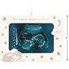 Hallmark Keepsake Christmas Ornament 2025, Sweetest Dream Come True 2025 Photo Frame, Porcelain, New Baby Gifts(2025 Sonogram Frame)
