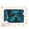 2025 Sonogram Frame